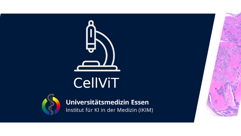 CellViT: Vision Transformers for Precise Cell Segmentation and Classification